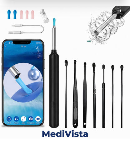 Kablosuz Wifi Kulak Temizleme Kamerası N7 Modeli 1296P HD KBB DOKTOR ONAYLI